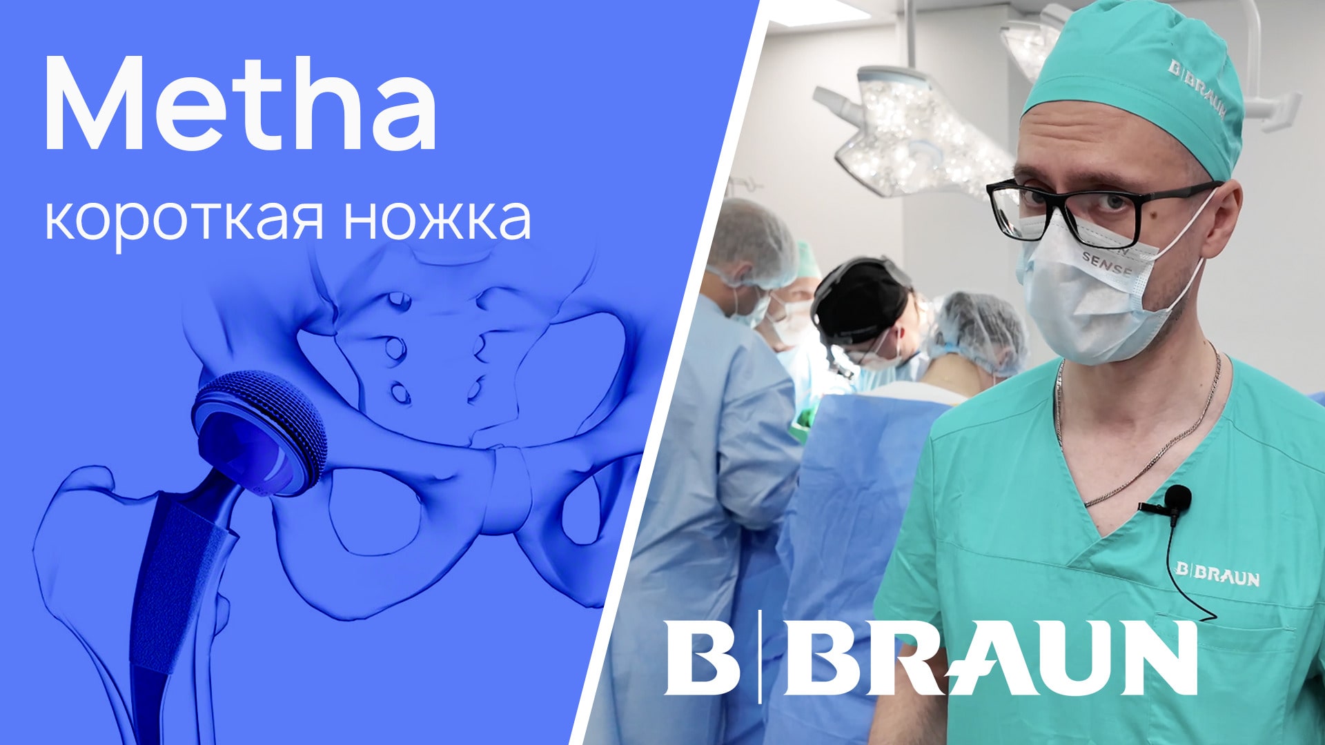 Короткая ножка Metha, Aesculap